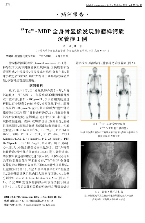 ^99Tc^m-MDP全身骨显像发现肿瘤样钙质沉着症1例