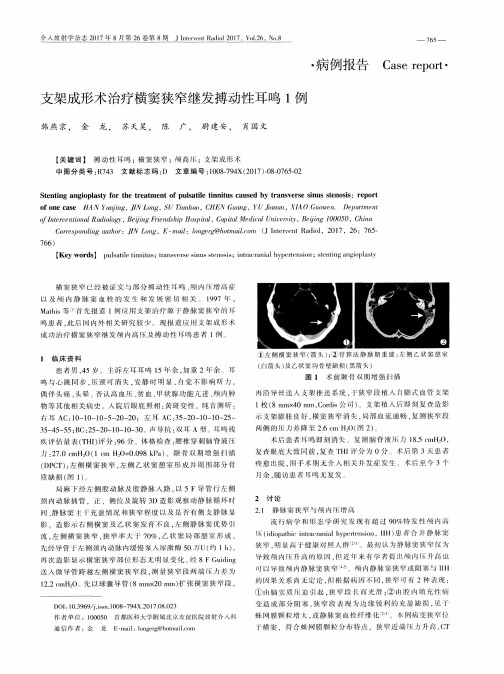 支架成形术治疗横窦狭窄继发搏动性耳鸣1例