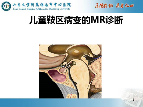 儿童鞍区病变MR诊断PPT课件