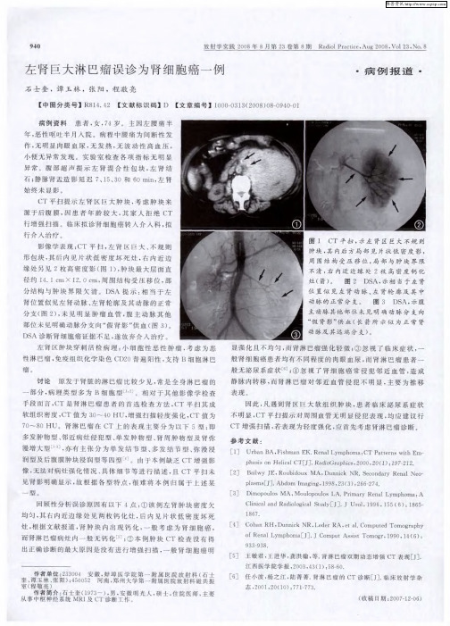 左肾巨大淋巴瘤误诊为肾细胞癌一例