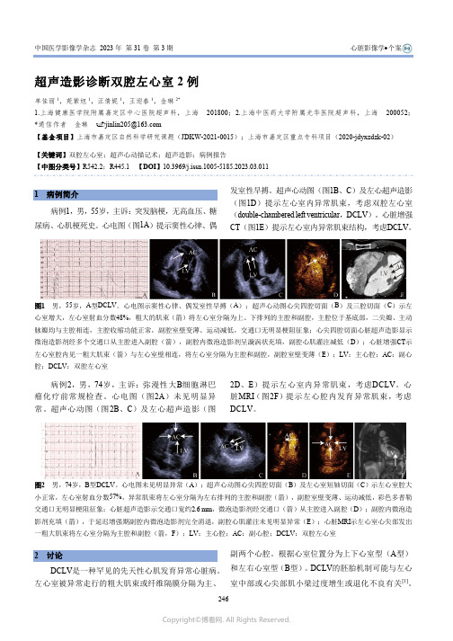 211057084_超声造影诊断双腔左心室2例