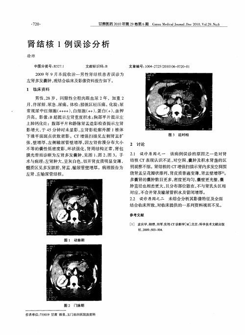 肾结核1例误诊分析