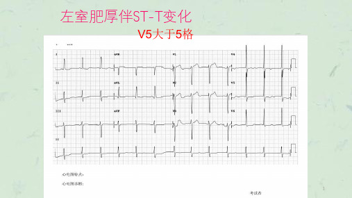 规培常见心电图课件