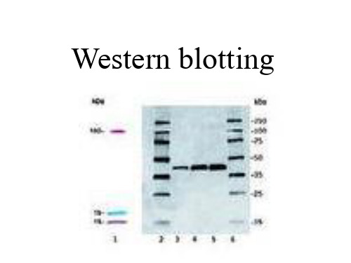 Western-blotting