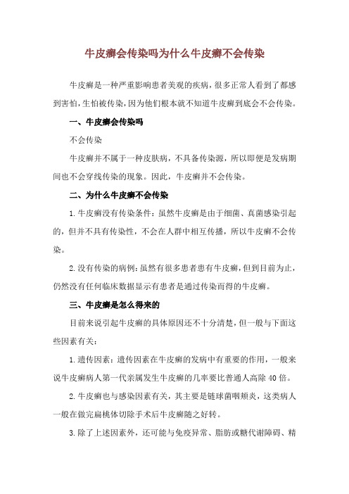 牛皮癣会传染吗 为什么牛皮癣不会传染