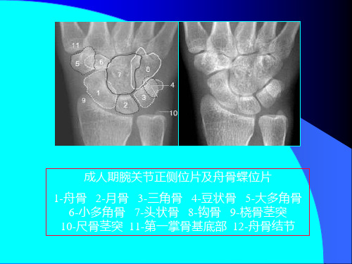 骨创伤腕关节解剖测量分析精品PPT课件