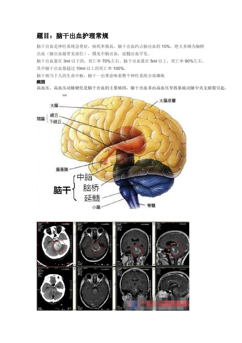 脑干出血护理常规