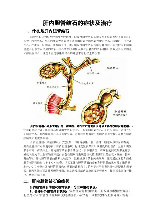 肝内胆管结石的症状及治疗