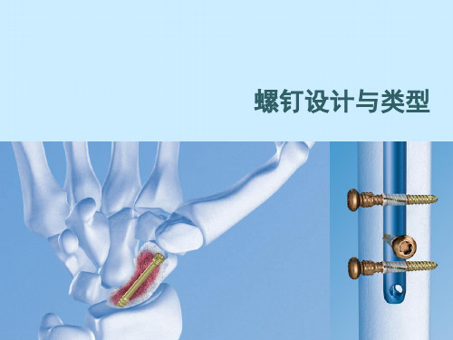 骨科基础螺钉设计与类型