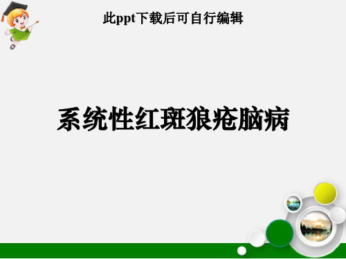 系统性红斑狼疮脑病ppt课件