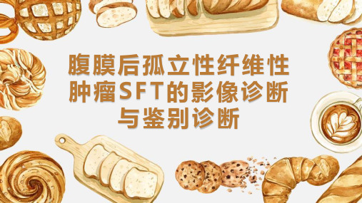 腹膜后孤立性纤维性肿瘤 SFT的影像诊断与鉴别诊断