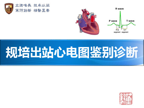 规培执业医师心电图鉴别诊断