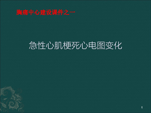 急性心肌梗死心电图变化PPT课件