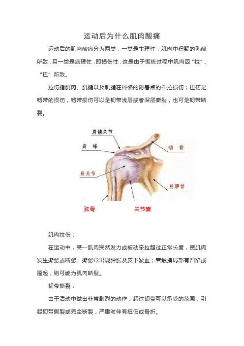 运动后为什么肌肉酸痛