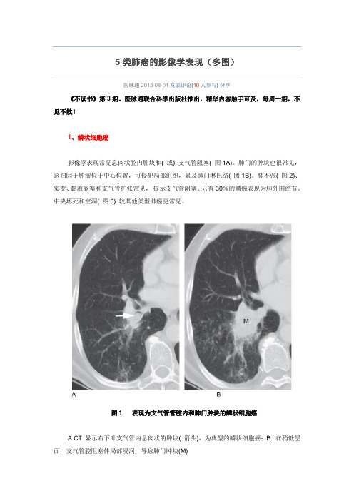 5类肺癌的影像学表现