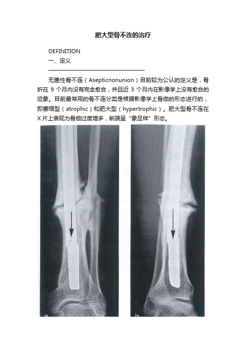 肥大型骨不连的治疗