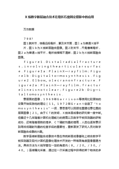 X线数字断层融合技术在骨折石膏固定摄影中的应用