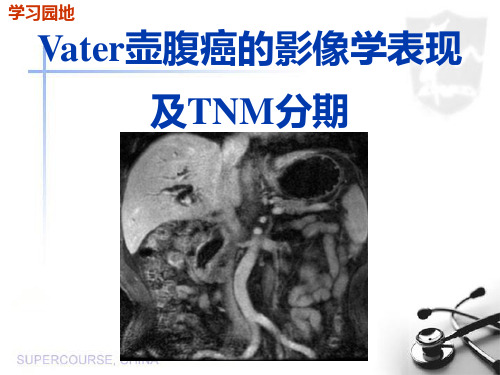 Vater壶腹癌的影像学表现及TNM分期