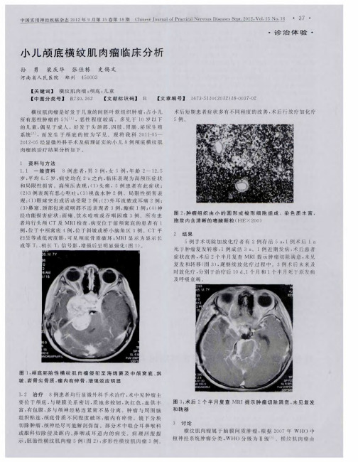 小儿颅底横纹肌肉瘤临床分析