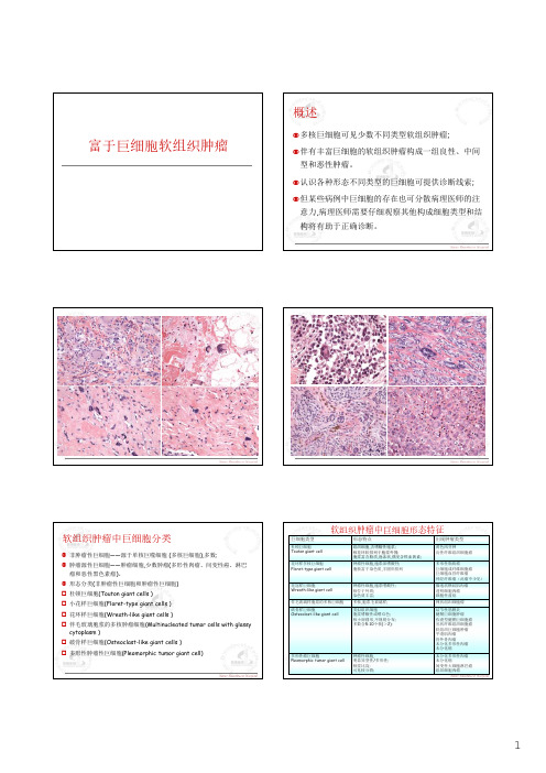 富于巨细胞软组织肿瘤