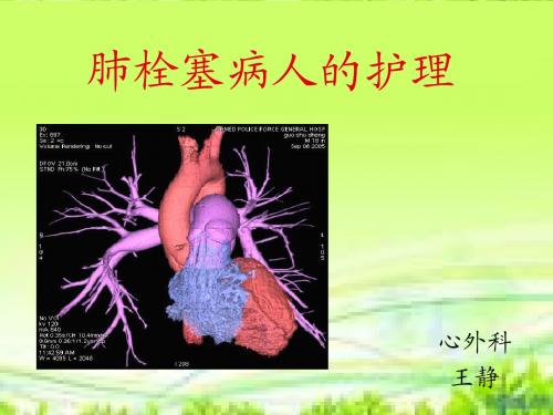 肺栓塞病人的护理1