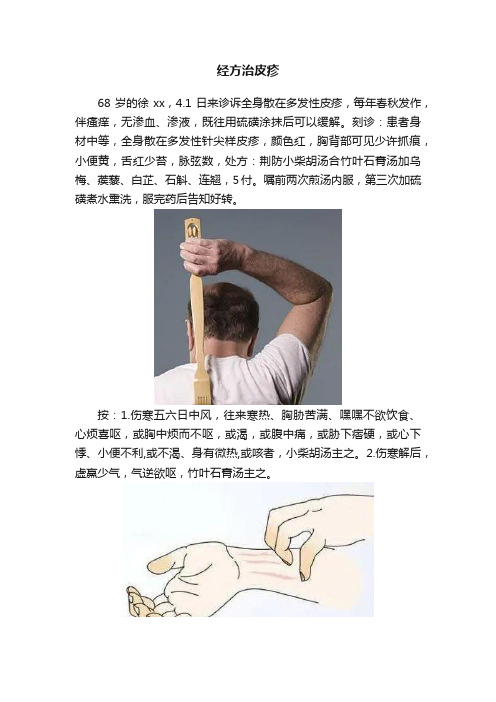 经方治皮疹