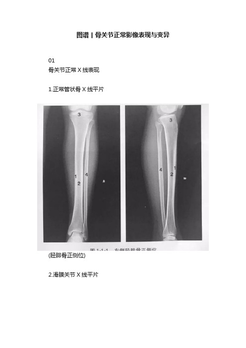 图谱丨骨关节正常影像表现与变异