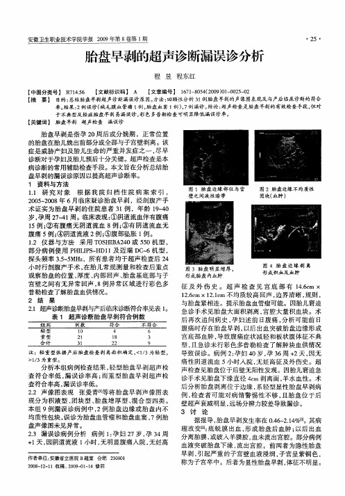 胎盘早剥的超声诊断漏误诊分析