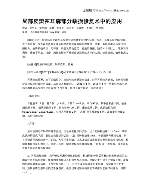 局部皮瓣在耳廓部分缺损修复术中的应用