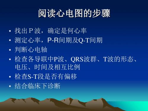 异常心电图图纸 ppt课件