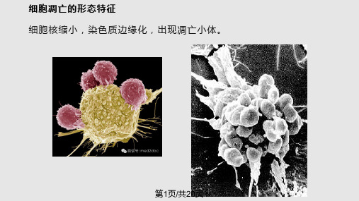 细胞凋亡的检测方法PPT课件