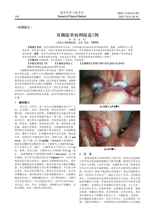 双侧隐睾病例报道1例