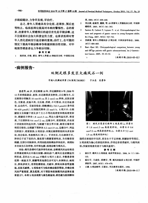 双侧足跟多发巨大痛风石一例