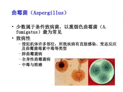曲霉菌病ppt