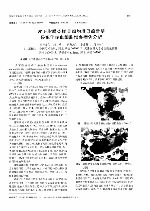 皮下脂膜炎样T细胞淋巴瘤骨髓侵犯伴噬血细胞增多病例分析