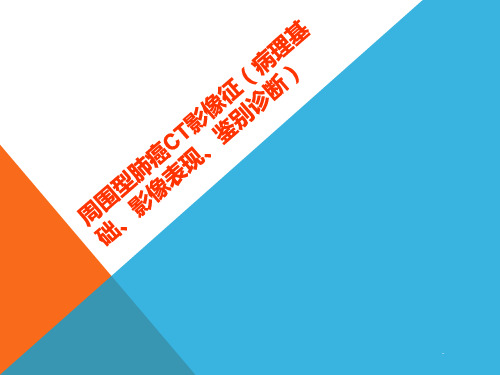 周围型肺癌CT影像征(病理基础、影像表现、鉴别诊断)