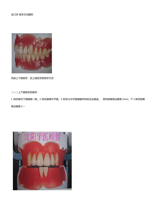 全口牙排牙方式图例