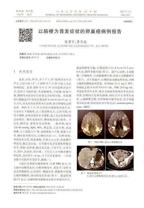 以脑梗为首发症状的卵巢癌病例报告