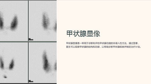 (核医学课件)08.甲状腺显像