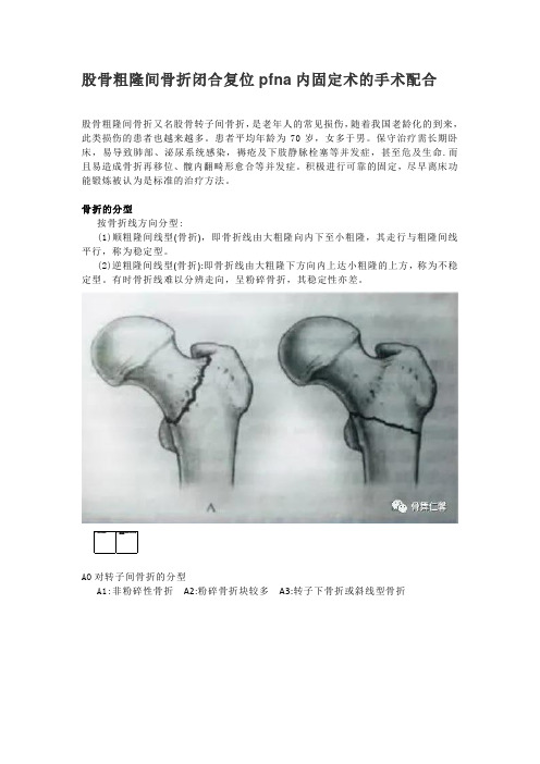 股骨粗隆间骨折PFNA内固定手术的护理配合