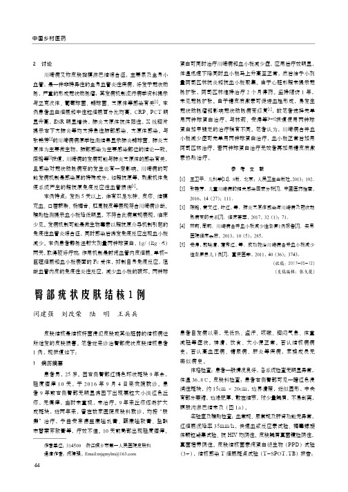 臀部疣状皮肤结核1例