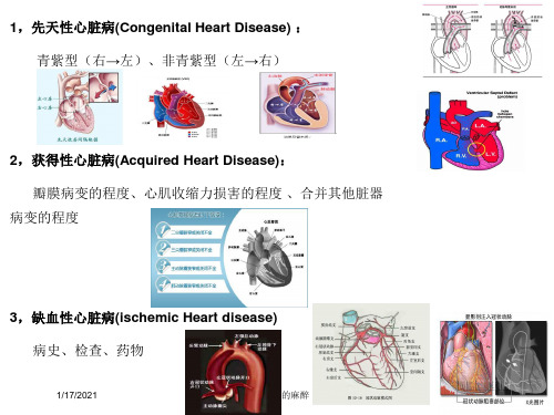 心脏病人的麻醉培训课件