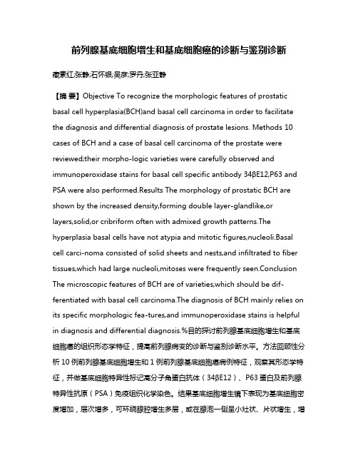 前列腺基底细胞增生和基底细胞癌的诊断与鉴别诊断