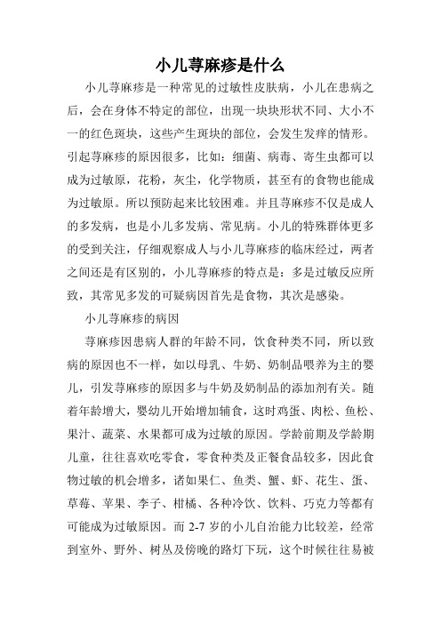 小儿荨麻疹是什么