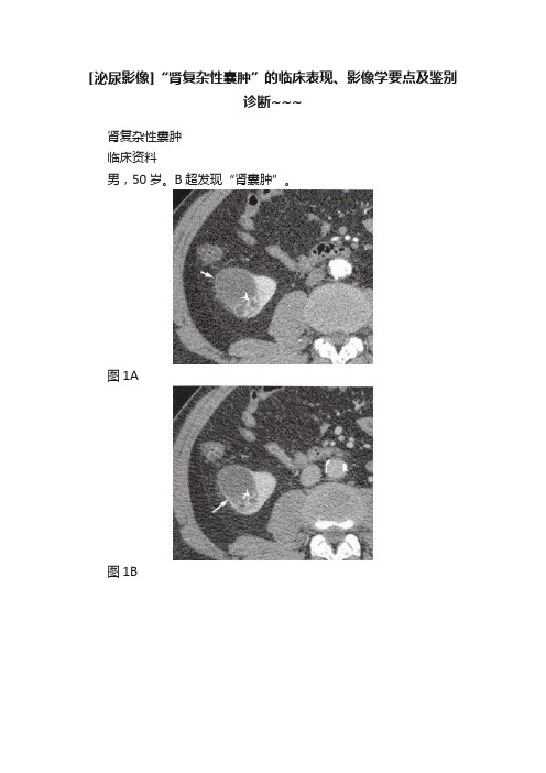 [泌尿影像]“肾复杂性囊肿”的临床表现、影像学要点及鉴别诊断~~~