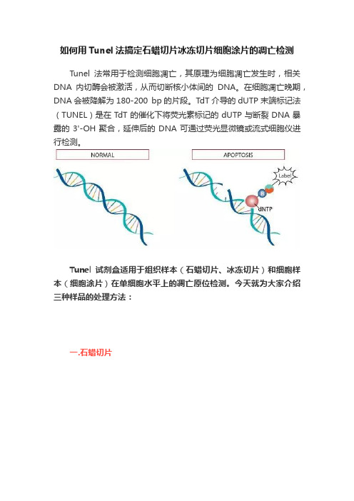 如何用Tunel法搞定石蜡切片冰冻切片细胞涂片的凋亡检测