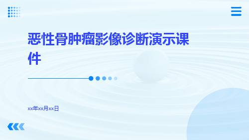 (医学课件)恶性骨肿瘤影像诊断演示课件