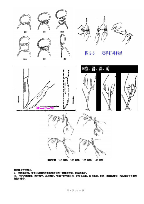 外科缝合