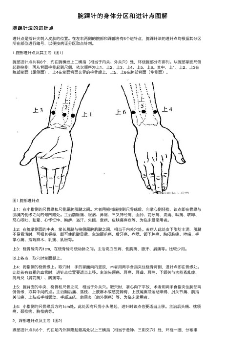 腕踝针的身体分区和进针点图解