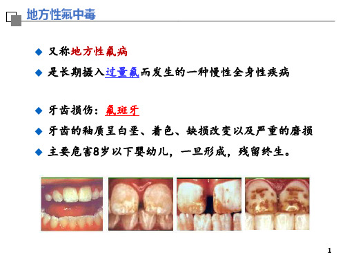 2.121.6地方性氟中毒预防医学
